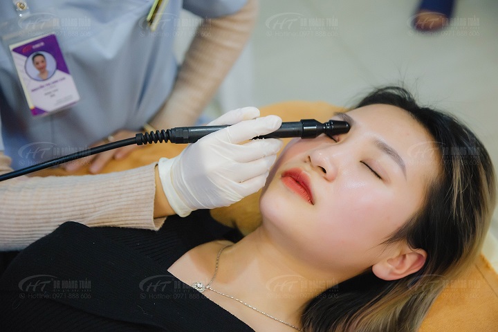 Khách hàng đang được chạy máy RF (miễn phí) giúp làm mềm và mờ sẹo nhanh hơn